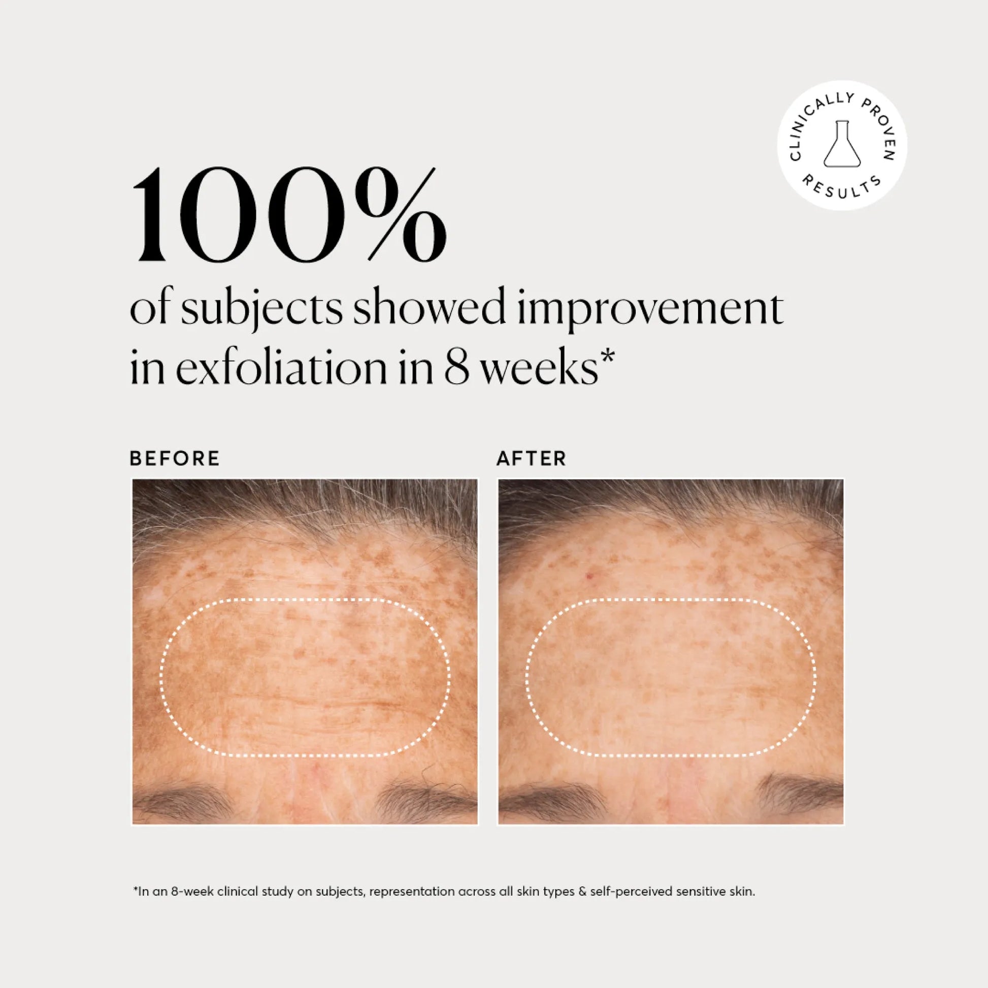bha-liquid-exfoliant-2-d7 NATR-10027-Alt-Images-BHA-Liquid-Exfoliant-2_-03.webp