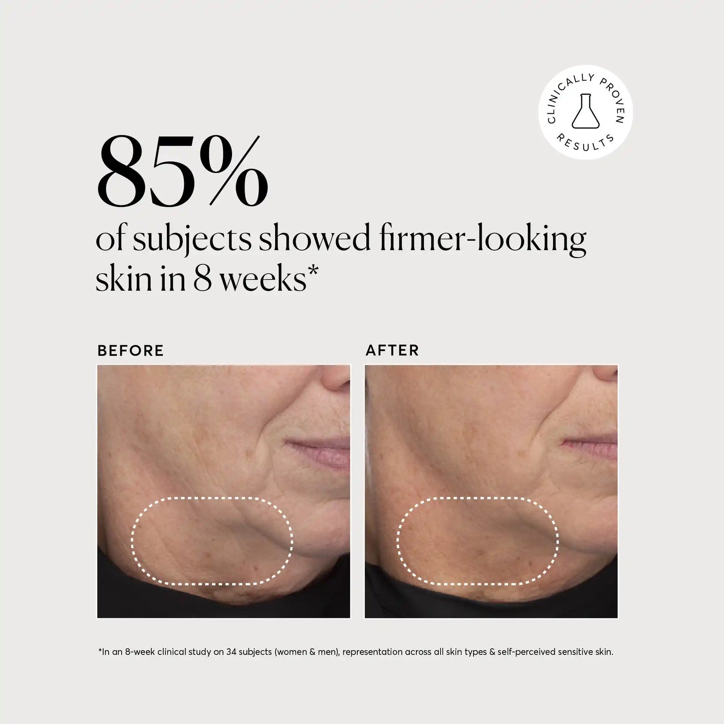 retinol-complex-serum-k1 NATR-10034-Alt-Images-Retinol-Complex-Serum-04.webp